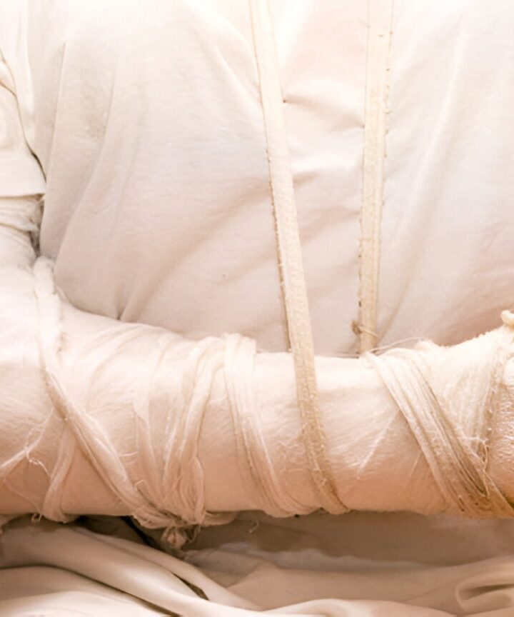 Henderson Elevator Accident Lawyer: Mechanical Failure Injury Claims